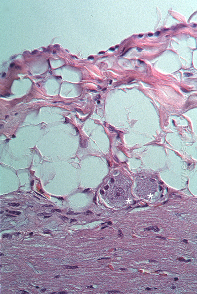 Serosal pericardium histology